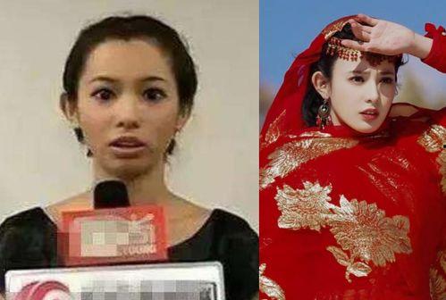 明星网红整容观,明星效应下的美丽追求与反思