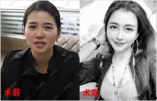 明星网红整容医院,美丽背后的秘密与风险