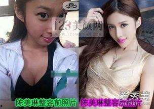 明星网红吧图片,明星网红吧图片集锦解析